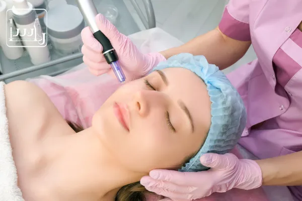 مزونیدلینگ صورت چیست؟| آیا مزونیدلینگ عوارض دارد؟