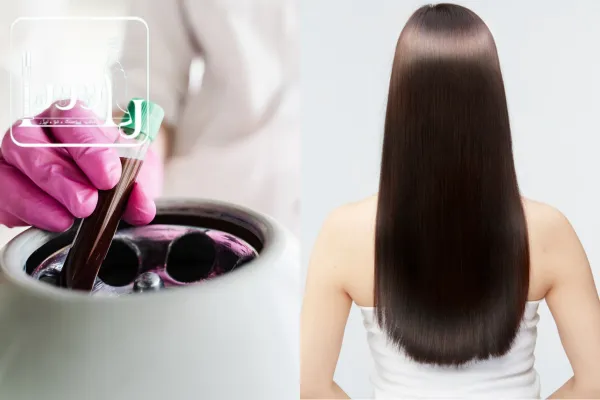 مزوتراپی بهتر است یا پی آر پی؟مقایسه مزوتراپی و پی آر پی مو
