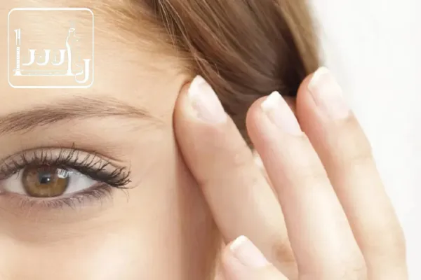 همه چیز درباره بوتاکس چشم گربه ای
