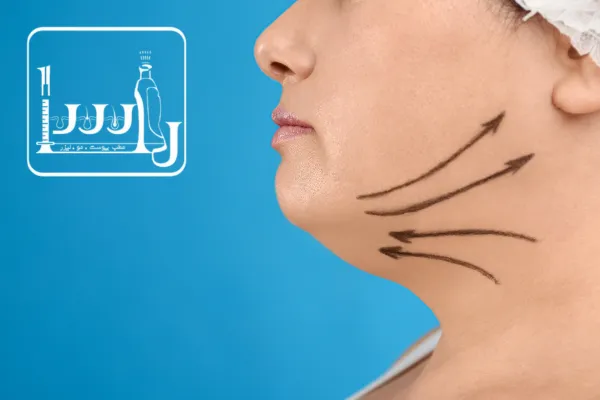 افزایش اعتماد به‌نفس با ساکشن غبغب