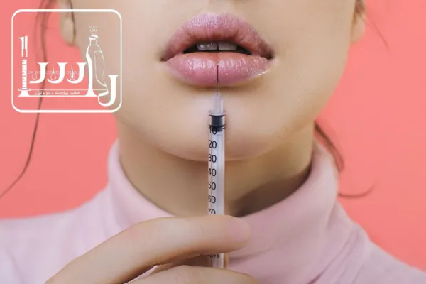مزایا و معایب ژل لب دائم و موقت
