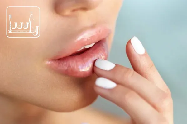 مراقبت‌های بعد از تزریق ژل لب روسی