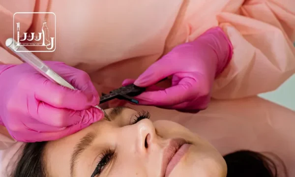 علت ریزش ابرو بعد از کاشت چیست