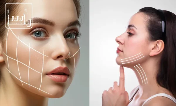 تفاوت بوکال فت و زاویه سازی صورت
