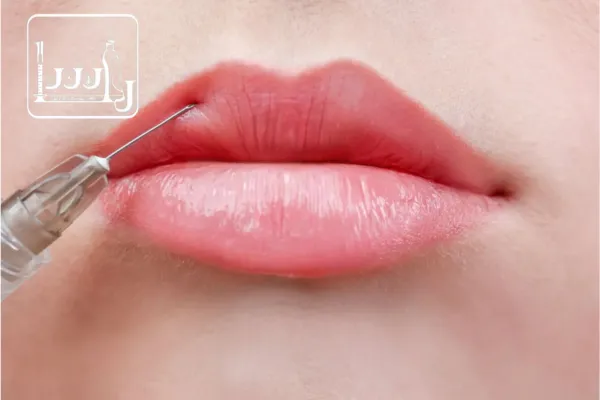 تفاوت ژل لب روسی و معمولی چیست؟