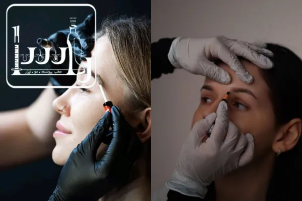 نحوه کاشت ابرو به روش FUE | کاشت ابرو کلینیک راسا در تهرانسر
